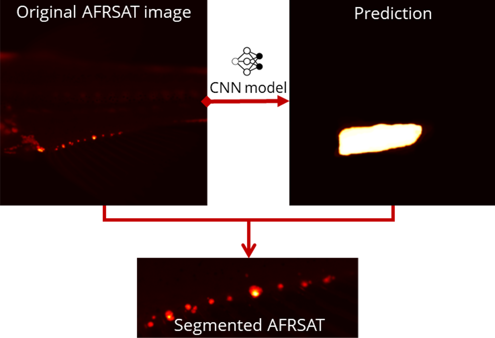 ZOTAS: CNN segmentation of adipose tissue